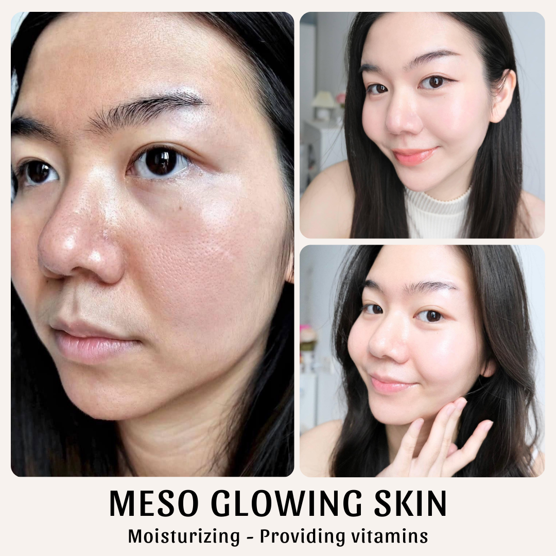 Skin Treatment