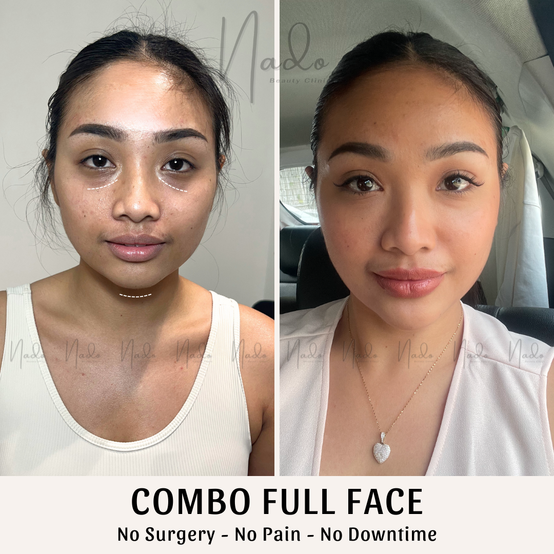 Full face