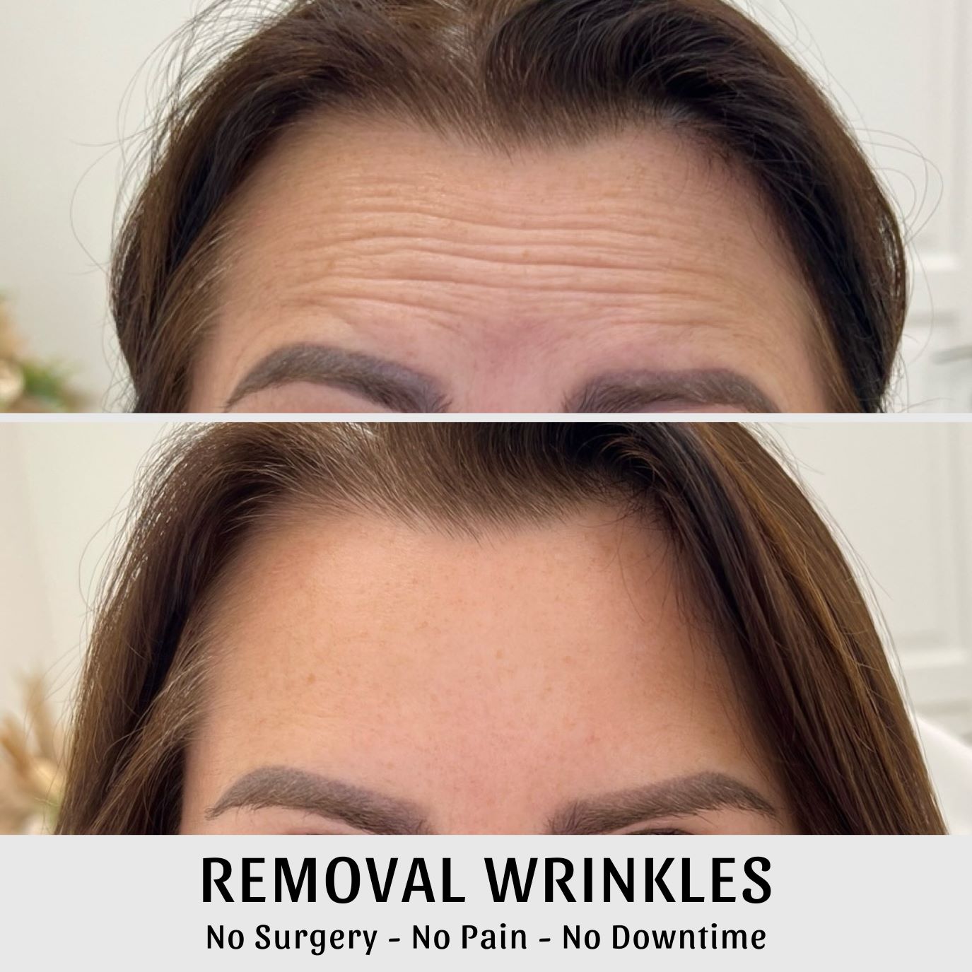 Remove wrinkles