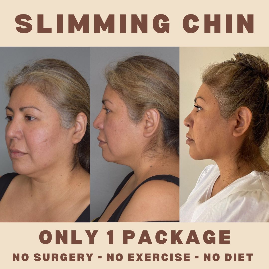 Chin/ Cheeks
