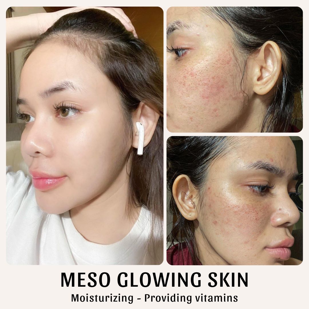 Meso Glowing Skin
