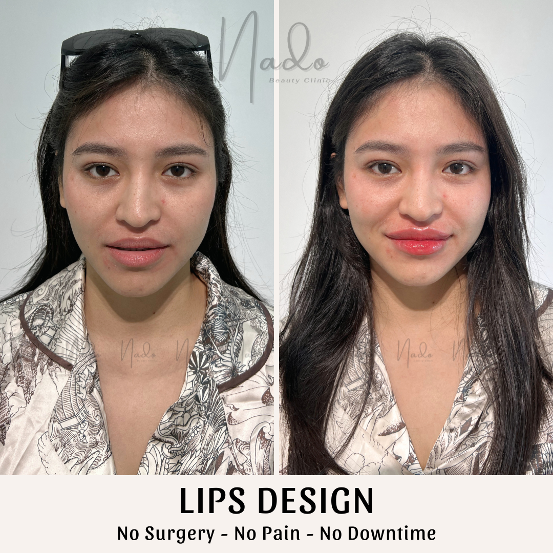 Lips Design